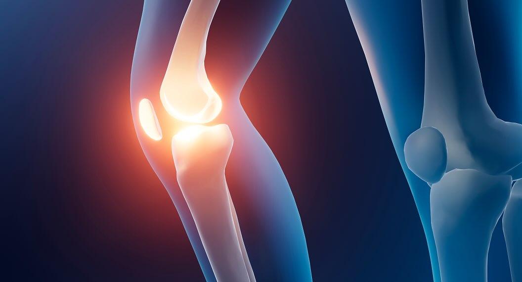 관절 통증 통증