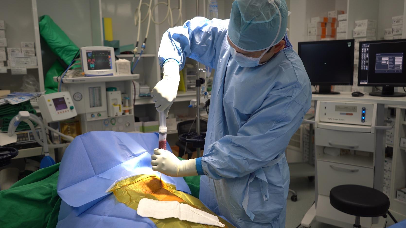 골반뼈에 국소마취후 소량의 골수를 채취 사진