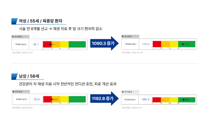Ginza ODA CLINIC의 면역세포 치료 사례 이미지