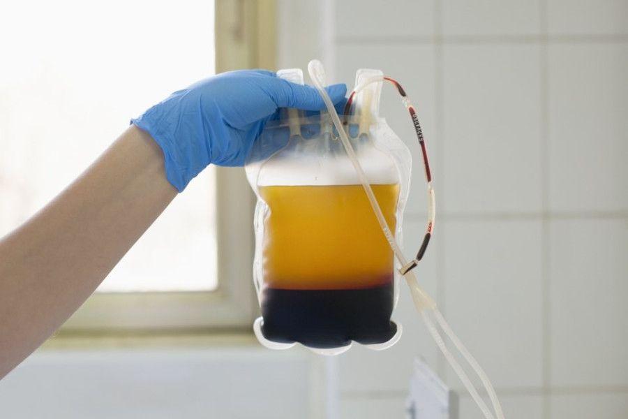 서울예스바이오, 혈장 동결 건조 및 제조방법 특허 출원 완료